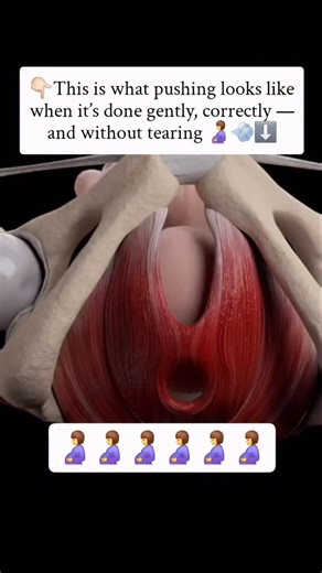 PeacefulBirthNow on Instagram: "Most mamas are told to just “push hard” when the time comes. But no one teaches you how to breathe. No one explains that pushing isn’t just about force — It’s about rhythm, awareness, and trust in your body. I didn’t know this during my first birth. I held my breath. I tensed up. And I ended up with pain, panic, and tearing. What I wish someone had told me back then: ✨ Breathe in through your nose slowly. ✨ Exhale gently through your mouth, like you’re blowing out