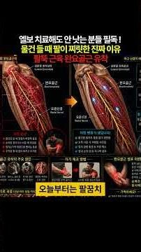 [강성통증] 팔꿈치 바깥쪽 통증, 테니스 엘보가 아닙니다 | 완요골근 속 '요골신경'을 구출하세요 👑 #테니스엘보 #팔꿈치통증 #완요골근 #요골신경 #팔뚝통증 #손목통증