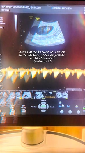 Lucas Milhomem | Stand Up Comedy on Instagram: "Esse momento é um dos mais importantes da nossa história, uma vida sendo gerada, e toda vida deve ser celebrada, com familiares, amigos e com vocês que acompanham tudo por aqui! Nosso bebê está crescendo e a caminho! Papai Lucas e Mamãe Nathalia te aguardam… 🤍"