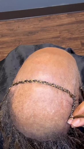 💜✨ Become a Certified Alopecia Braiding Specialist – Only $200! DM the word “Class” to sign up Now’s your chance to join Thebraider Hair Academy’s Online Alopecia Braiding Course 🎓 What You’ll Learn: 💜 Safe, tension-free techniques for clients with alopecia or sensitive scalps�💜 Lace customization & frontal integration step-by-step�💜 Proper scalp prep, sanitation, and client consultations�💜 Pricing, branding, and how to position yourself as a specialist�💜 Plus — a printable certificate up