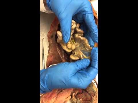 Cat Digestive - Abdominal Cavity