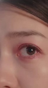 Eyelid discomfort—like dryness, redness, or irritation—can feel confusing when the cause isn’t obvious. Learn about everyday factors often discussed in eyelid sensitivity information. | 17sell