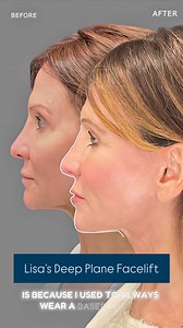 52 comments | “I used to wear baseball caps to hide my face!” Our...