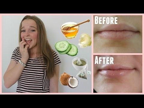 Easy Ways to Cure Chapped Lips in Minutes!