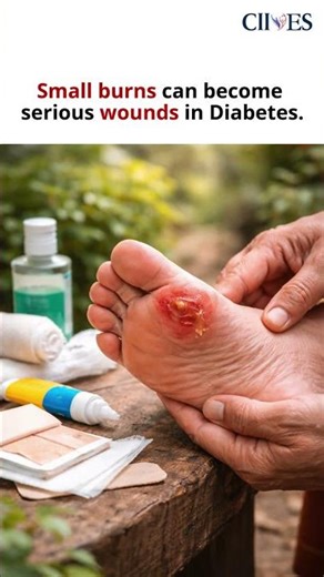 Hot concrete surfaces in summer can cause serious burns on the feet #shorts #shortvideo