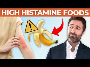 STOP Eating These Foods If You Have Histamine Intolerance