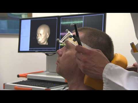 Navigated Brain Stimulation for presurgical mapping and tractography