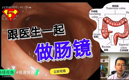 肠镜是怎么做的？第一视角带你解读检查全过程