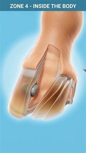 HOW THEY FIX A COW'S INJURED HOOF