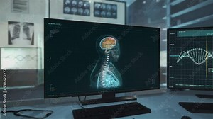 Modern Biotechnology Patient Health Diagnostic Interface At Hospital. Patient Health Status Monitoring Interface Examination. Patient Health Diagnosis X-Ray Scan Interface. UI. Medical Technology