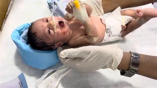 12K views · 229 reactions | Premature Newborn With Oral Secretions |...