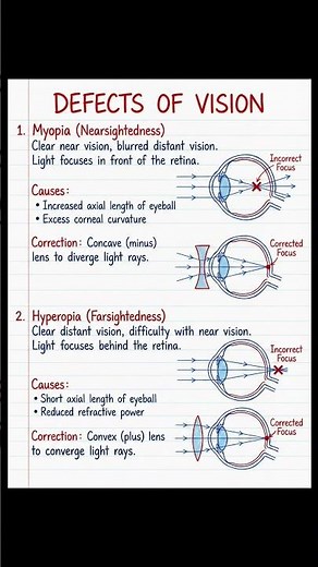 Why distant or near objects look blurry??? #hyperopia #myopia #biology #vision #education