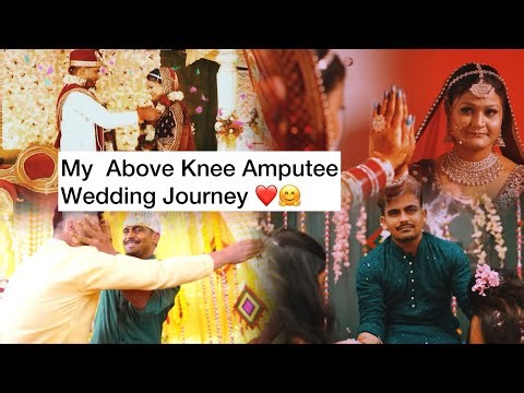 Love Knows No Bounds || My Above Knee Amputee Wedding Journey || Wedding Highlights #amputee #leg