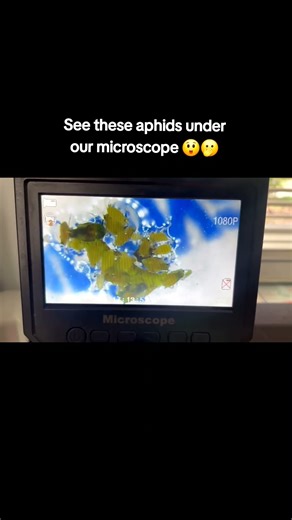 See this group of aphids under a microscope 😲🫢🐛 #aphid #pets #microscope #farming #agriculture