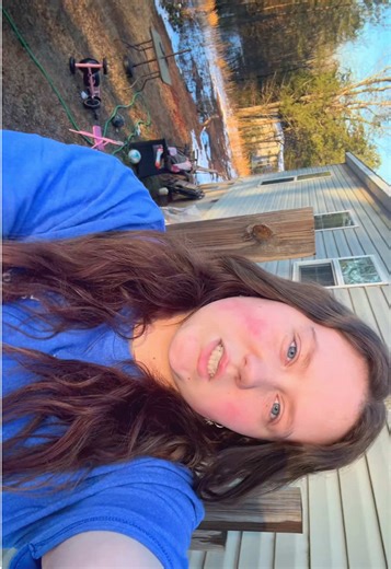 We’re gonna ignore the fuzz and how I look 👍 IT’S PRETTY OUTSIDE!!