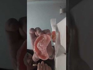 Applying adhesive to my dentures 2