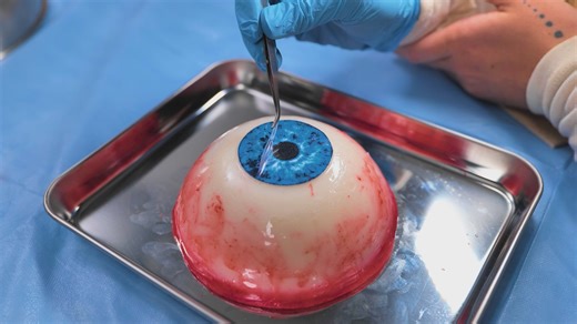 The World of Surgery — Explained Simply | 5-Minute Crafts Family