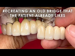How to Recreate an Old Bridge That the Patient Already Likes
