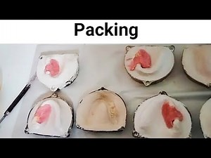 Step#08 Packing #partial_denture #smartdentistrt