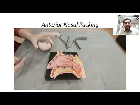 Anterior Nasal Packing for Epistaxis