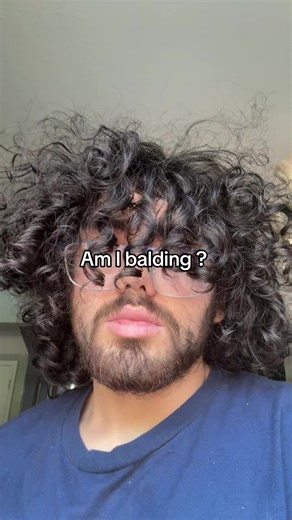 Signs You Might Be Balding