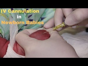 IV Cannulation in Newborn Babies - Complete Guide in just 3 minutes