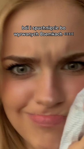 boli bardzo wygladam jak chomik 😩