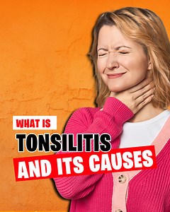 What is Tonsilitis , Its causes and how to keep yourself safe from it. | Doctor ASKY