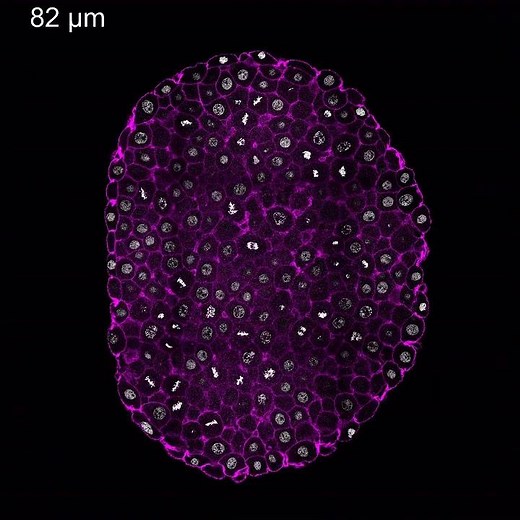 Fluorescence imaging of a Zebrafish embryo