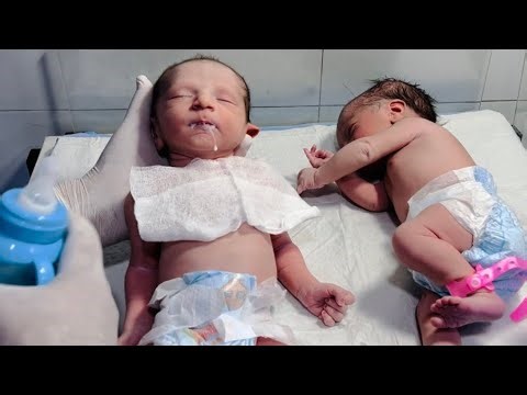 Cutest Twin Babies in NICU First Feeding After C-Section 👶👶❤️ | One Boy & One Girl #TwinBabies🤲🙏❤️