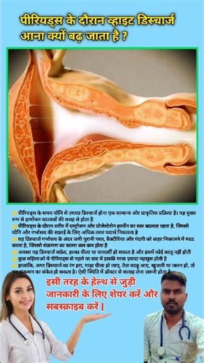 Why does white discharge increase during periods? White discharge during Periods || #viral