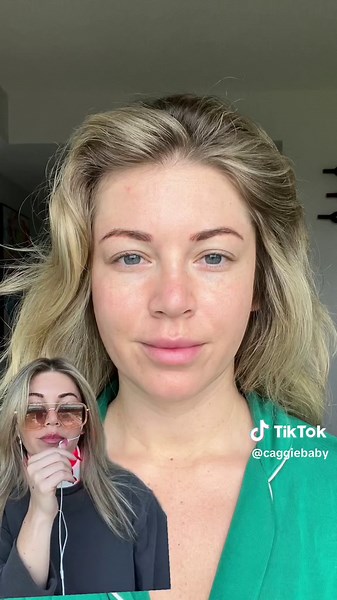 ZIIP Halo Microcurrent Device 9 Month Skin Transformation Update