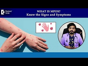 Monkeypox rash on skin | MPox Symptoms & Diagnosis| Mpox Phases-Dr.Leela Mohan P V R|Doctors' Circle