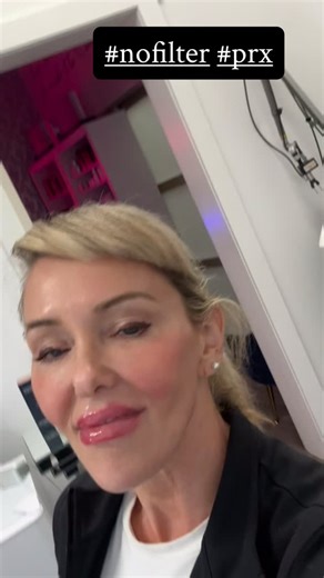 PRX Treatment #3, book yours today. #glassskin #perfectdermapeel #prx #intheskinatx #skinparloratx | In The Skin ATX