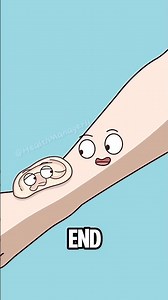 Ears growing out of arms? Is that even possible?#shorts