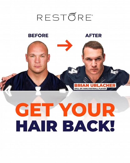 We're changing the game when it comes to hair restoration. Thanks to our RESTORE® No-Shave FUE™, RESTORE is bringing back hairlines AND confidence quickly. | Restore Hair