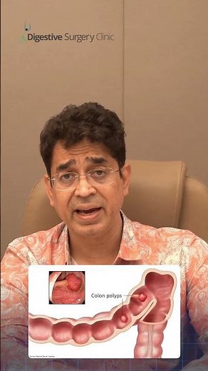 Colonic Polyps & Cancer Risk: Dr. Sarfaraz Baig Explains the Genetic Link