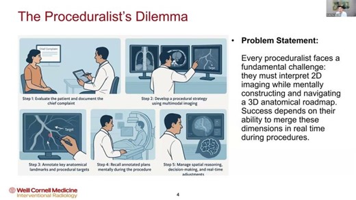 Beyond the Image: A Paradigm Shift in Clinical Workflow with 3D Fusion and Augmented Reality | Gaurav Gadodia, M.D.