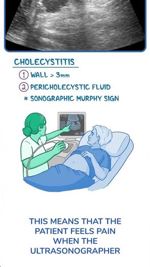 Diagnostics on Demand: Cholecystitis