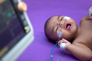 What Are the Signs of Respiratory Distress in Newborns?