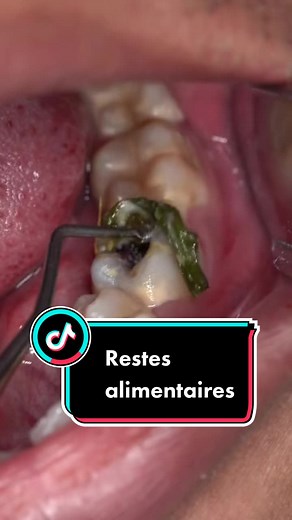 Dental Procedure Insights with Dr. Kevin