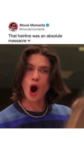 That hairline was an absolute massacre 💀