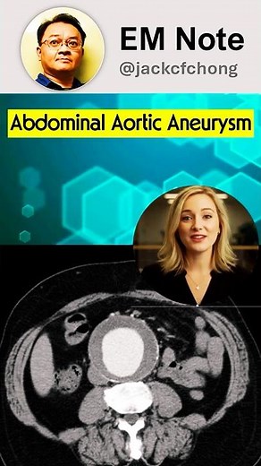 Abdominal Aortic Aneurysm：AAA