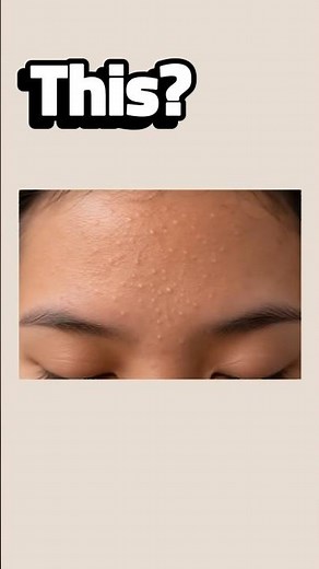 Homemade Rice Mask for Glass & Clear Skin #skincare #rice #acne #clearskin #trending #homemade #diy