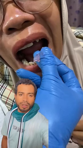 Tomar una buena decisión esa amarce , asimismo, pese los comentarios #fblifestyle | Laboratorio D protesis Mr NigiDent.