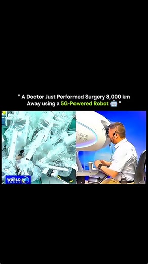 SCIENCE - EXPLAINED | A doctor just performed life-saving surgery 8,000 km away using a 5G-powered robotic system — and it’s not science fiction anymore.... | Instagram