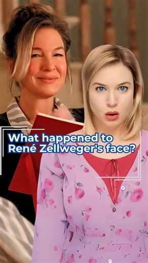 #ReneéZellweger breaks the silence! The #BridgetJones star finally confesses the real reason for the changes in her face. #Zellweger #bridgetjonesdiary #Editorial | Icons