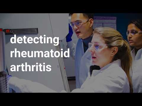 Detecting Rheumatoid Arthritis Before the Pain Starts