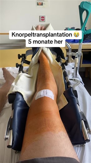 Understanding Cartilage Transplants for Knee Injuries