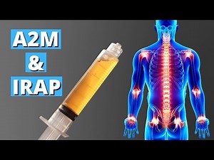 A2M And IRAP Injection For Joint Arthritis | Alpha-2 Macroglobulin And Interleukin-1 Recepter Antag